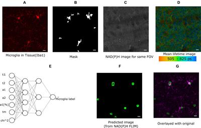 Machine Learning Methods for Fluorescence Lifetime Imaging (FLIM) Based Label-Free Detection of Microglia